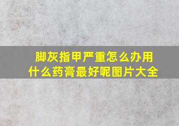 脚灰指甲严重怎么办用什么药膏最好呢图片大全