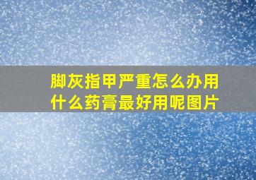 脚灰指甲严重怎么办用什么药膏最好用呢图片