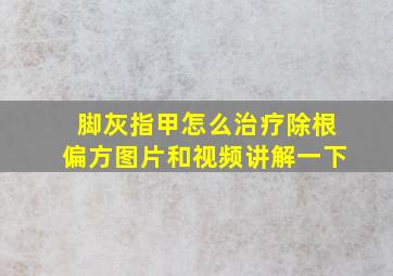 脚灰指甲怎么治疗除根偏方图片和视频讲解一下