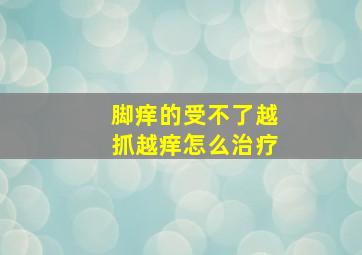 脚痒的受不了越抓越痒怎么治疗