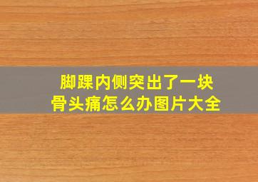 脚踝内侧突出了一块骨头痛怎么办图片大全