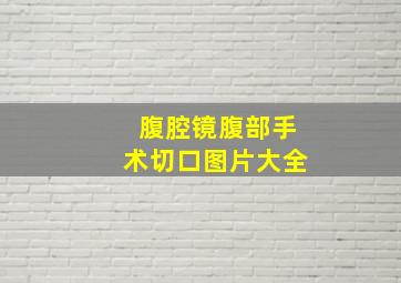 腹腔镜腹部手术切口图片大全