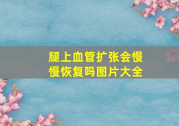 腿上血管扩张会慢慢恢复吗图片大全