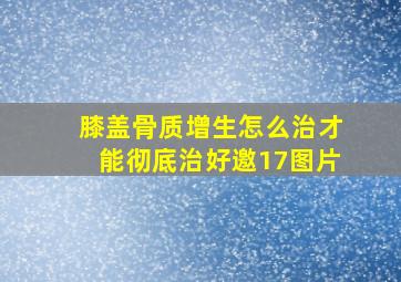 膝盖骨质增生怎么治才能彻底治好邀17图片