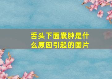 舌头下面囊肿是什么原因引起的图片