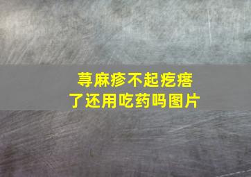 荨麻疹不起疙瘩了还用吃药吗图片