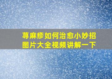 荨麻疹如何治愈小妙招图片大全视频讲解一下