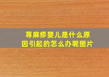 荨麻疹婴儿是什么原因引起的怎么办呢图片