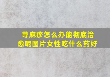 荨麻疹怎么办能彻底治愈呢图片女性吃什么药好