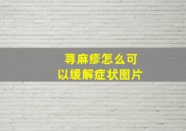 荨麻疹怎么可以缓解症状图片