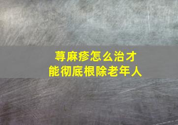 荨麻疹怎么治才能彻底根除老年人