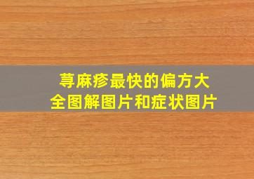 荨麻疹最快的偏方大全图解图片和症状图片