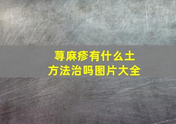 荨麻疹有什么土方法治吗图片大全