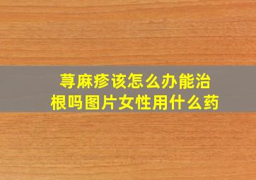 荨麻疹该怎么办能治根吗图片女性用什么药