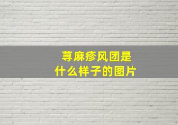 荨麻疹风团是什么样子的图片