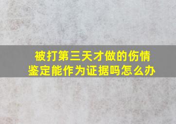 被打第三天才做的伤情鉴定能作为证据吗怎么办