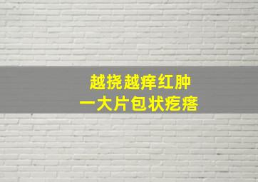 越挠越痒红肿一大片包状疙瘩