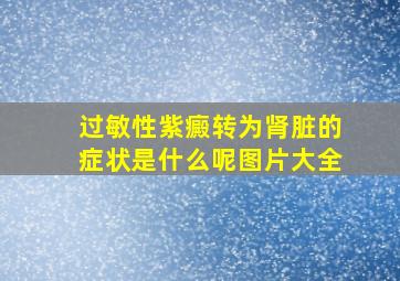 过敏性紫癜转为肾脏的症状是什么呢图片大全