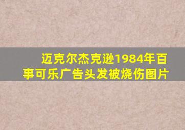 迈克尔杰克逊1984年百事可乐广告头发被烧伤图片