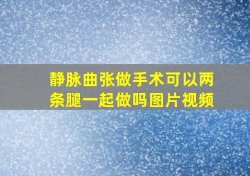 静脉曲张做手术可以两条腿一起做吗图片视频