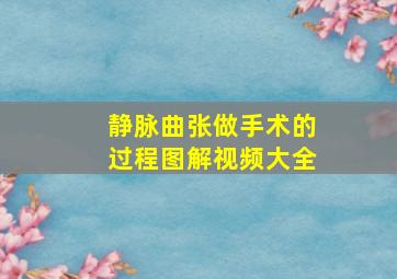 静脉曲张做手术的过程图解视频大全