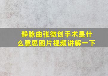 静脉曲张微创手术是什么意思图片视频讲解一下