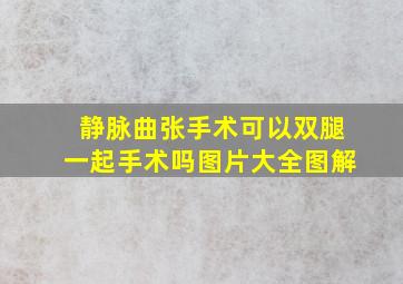 静脉曲张手术可以双腿一起手术吗图片大全图解