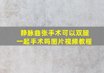 静脉曲张手术可以双腿一起手术吗图片视频教程