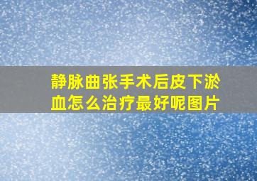 静脉曲张手术后皮下淤血怎么治疗最好呢图片