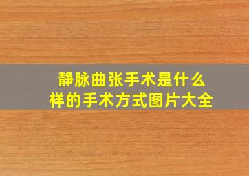 静脉曲张手术是什么样的手术方式图片大全