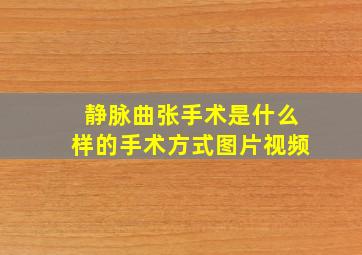 静脉曲张手术是什么样的手术方式图片视频