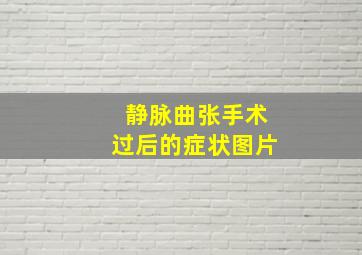 静脉曲张手术过后的症状图片