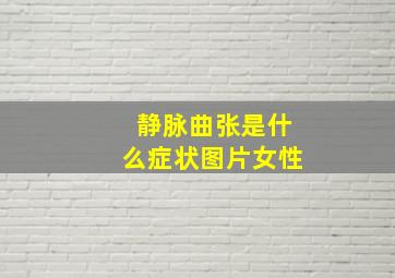 静脉曲张是什么症状图片女性