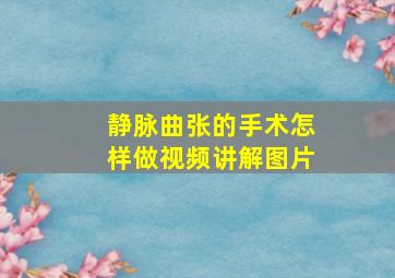 静脉曲张的手术怎样做视频讲解图片