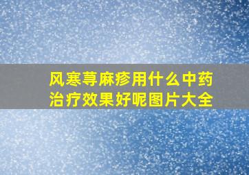 风寒荨麻疹用什么中药治疗效果好呢图片大全