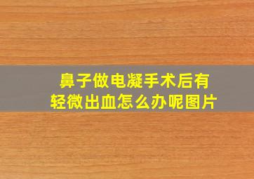 鼻子做电凝手术后有轻微出血怎么办呢图片