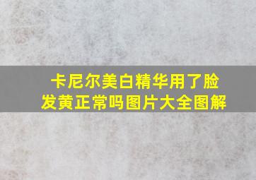 卡尼尔美白精华用了脸发黄正常吗图片大全图解