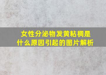 女性分泌物发黄粘稠是什么原因引起的图片解析