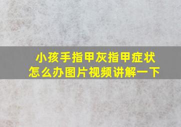 小孩手指甲灰指甲症状怎么办图片视频讲解一下