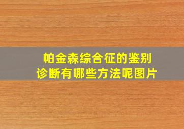 帕金森综合征的鉴别诊断有哪些方法呢图片