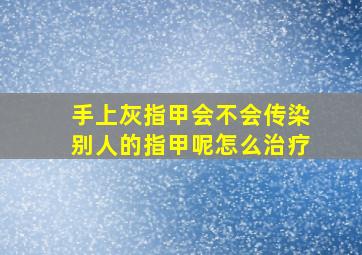 手上灰指甲会不会传染别人的指甲呢怎么治疗