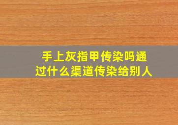 手上灰指甲传染吗通过什么渠道传染给别人