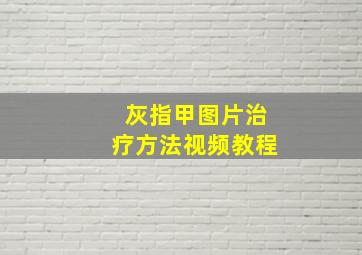 灰指甲图片治疗方法视频教程