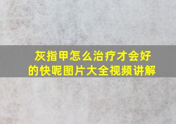 灰指甲怎么治疗才会好的快呢图片大全视频讲解