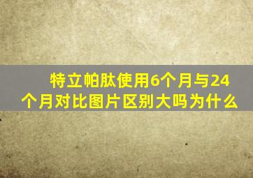 特立帕肽使用6个月与24个月对比图片区别大吗为什么