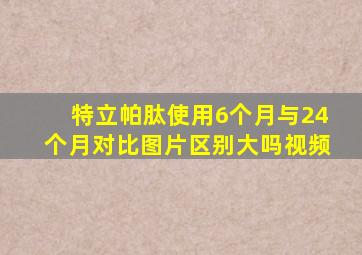 特立帕肽使用6个月与24个月对比图片区别大吗视频