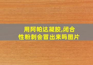 用阿帕达凝胶,闭合性粉刺会冒出来吗图片