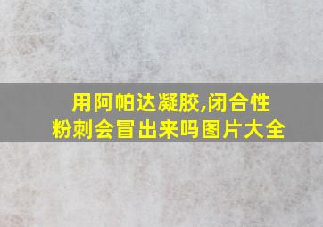 用阿帕达凝胶,闭合性粉刺会冒出来吗图片大全