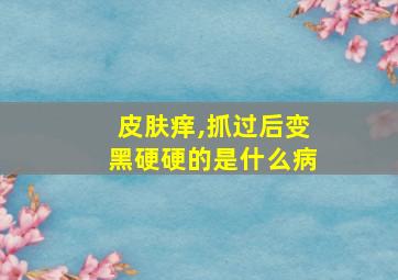 皮肤痒,抓过后变黑硬硬的是什么病