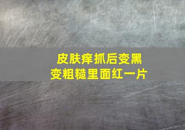 皮肤痒抓后变黑变粗糙里面红一片